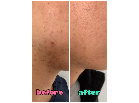 DETOCYCLE＆Si belles効果2