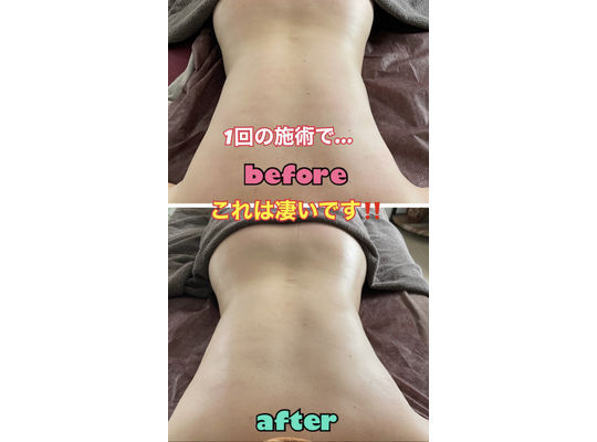 DETOCYCLE＆Si belles効果5