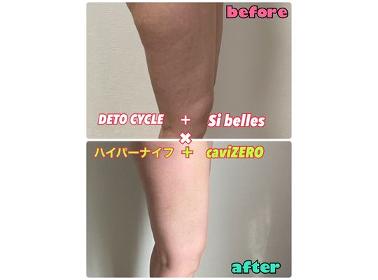 DETOCYCLEの効果７