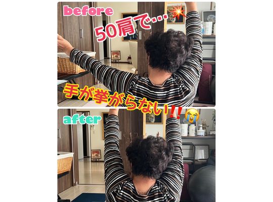 50肩痛の改善