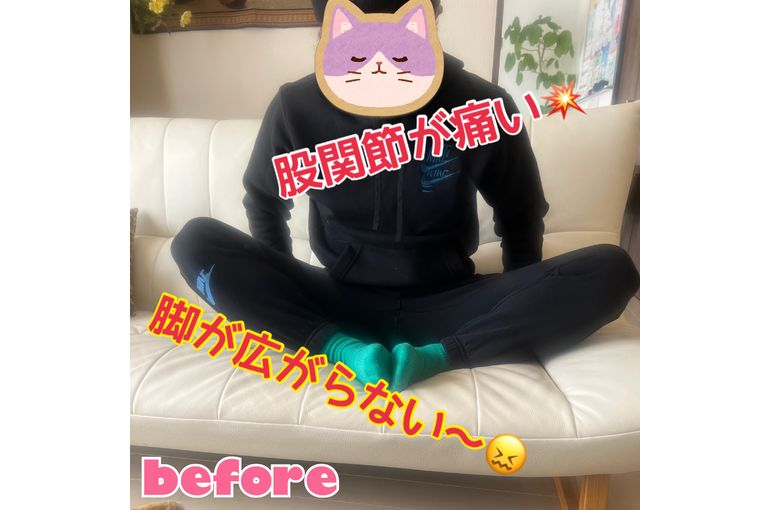 つらい股関節の痛み