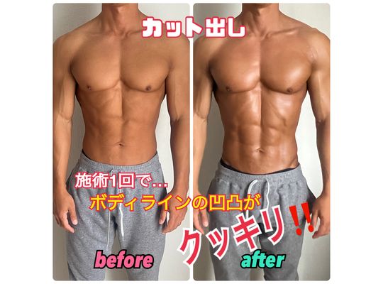 ハイパーナイフ＆キャビゼロのカット出し効果１